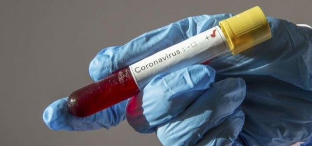 KKTC'de son bir haftada koronavirüsten 2 can kaybı oldu; 1439 yeni vaka saptandı